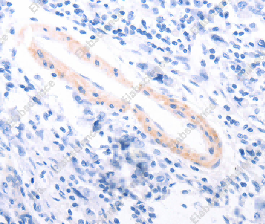 TPM1 Polyclonal Antibody - 3