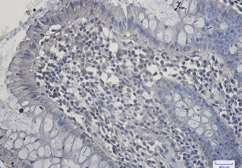 Recombinant SIRT2 Monoclonal Antibody - 3