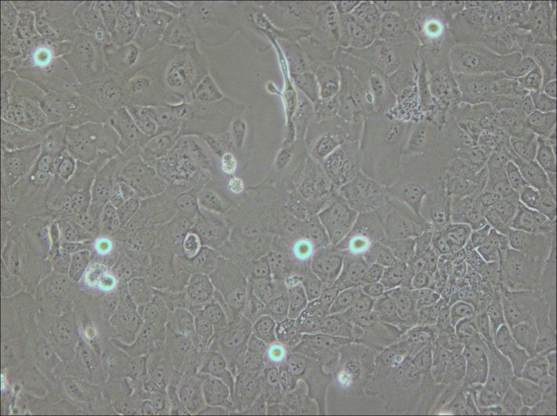 SCC-9 [SCC 9; SCC9] Cell Complete Medium - small - 5