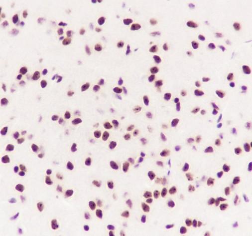 Recombinant AKT1+AKT2+AKT3 Monoclonal Antibody - small - 4