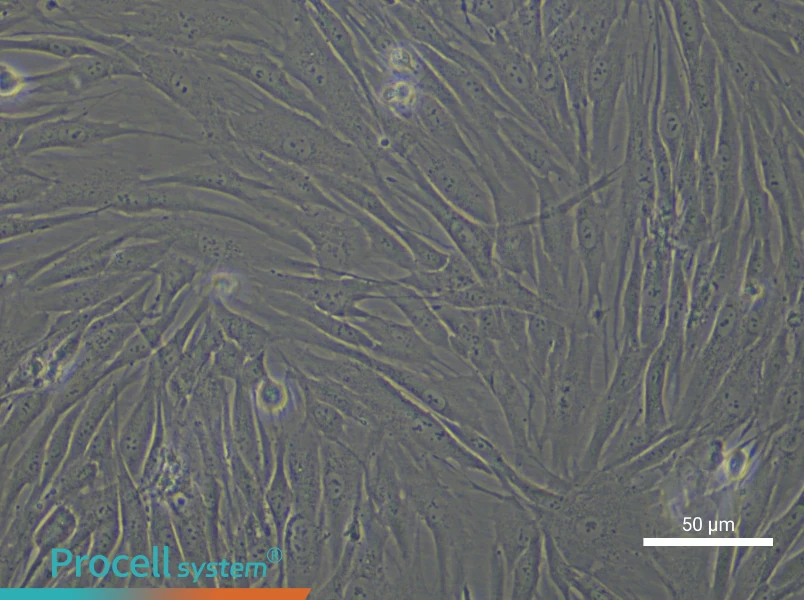 Human Gingival Fibroblast Complete Medium - small - 4