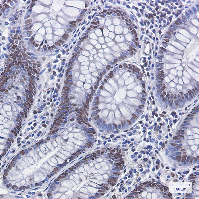 Recombinant Phospho-MDM2 (Ser166) Monoclonal Antibody - 2