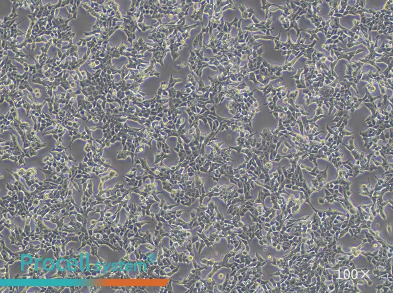 22RV1 Cell Complete Medium - 2