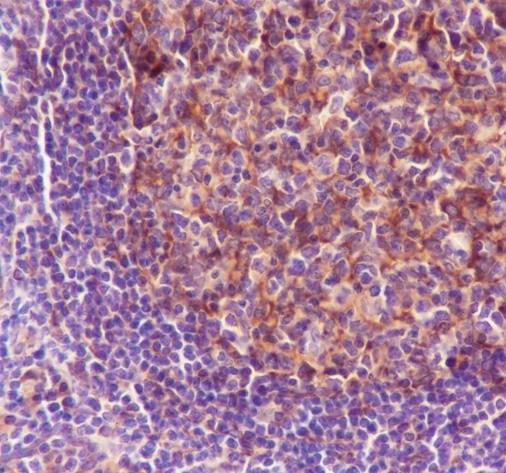 Recombinant MYO1C Monoclonal Antibody - small - 2