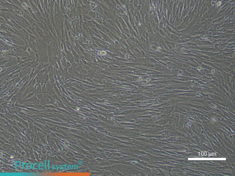 Human Lung Fibroblast Complete Medium - 3