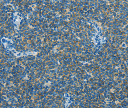 CAV3 Polyclonal Antibody - 3
