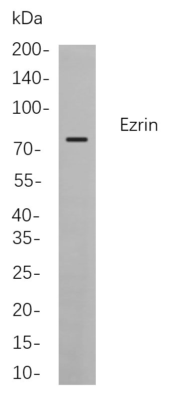 Recombinant Ezrin Monoclonal Antibody-searchlist-1
