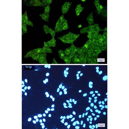 Recombinant EGFR/HER1/ErbB1 Monoclonal Antibody - small - 4