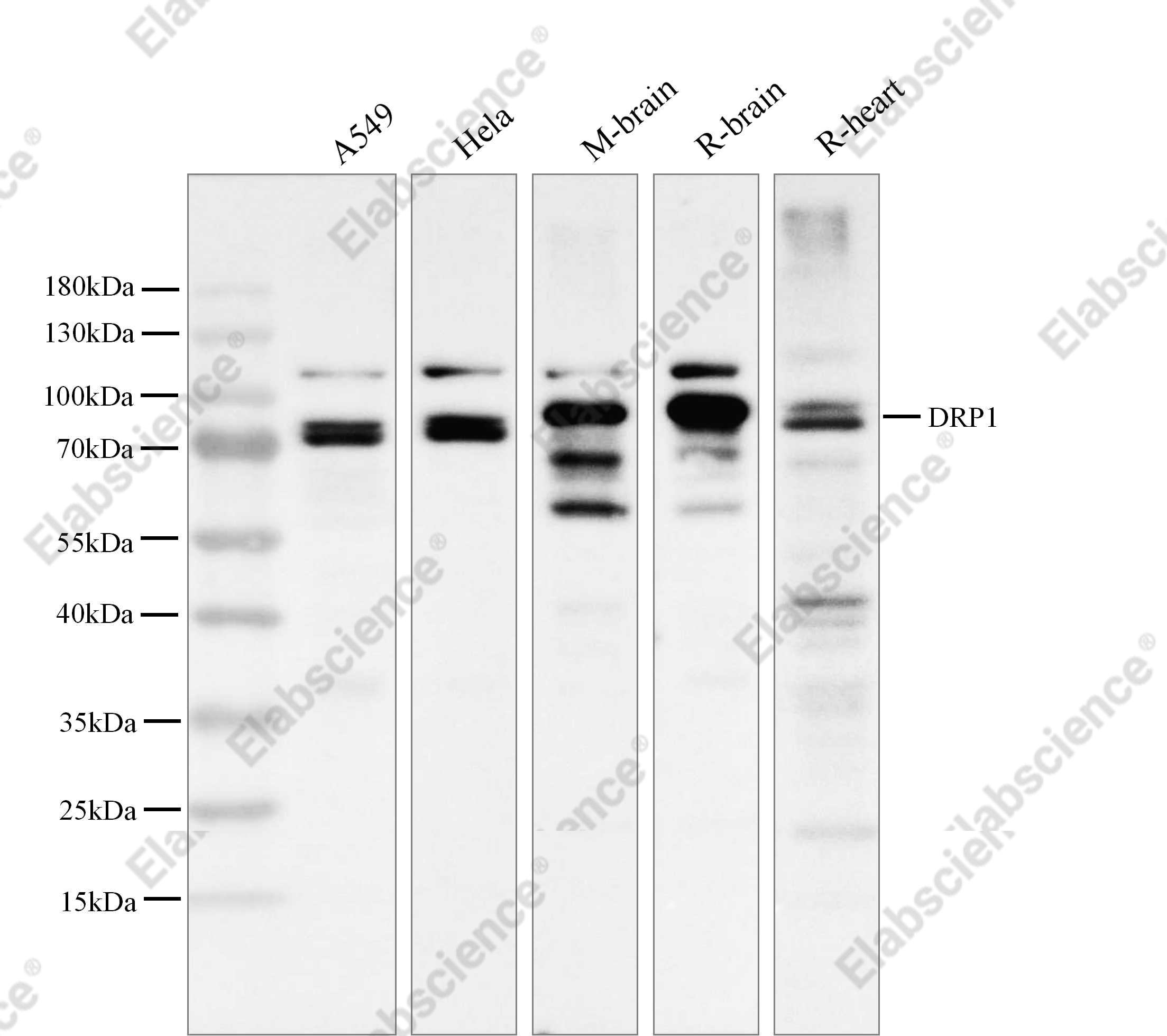 Recombinant DRP1 Monoclonal Antibody - 1