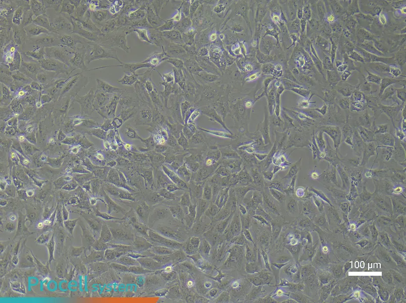 Rat Cardiac Fibroblast Complete Medium - 1