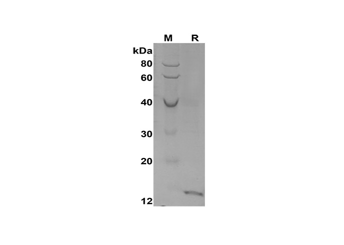 Recombinant Human CXCL10 Protein(His Tag)-1