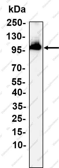 Recombinant NUP98 Monoclonal Antibody - 1