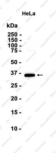 Recombinant Spry-2 Monoclonal Antibody - 1