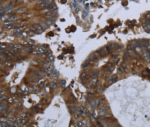 GLUL Polyclonal Antibody - 3