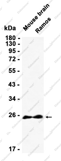 Recombinant Casein Kinase 2 beta Monoclonal Antibody - 1