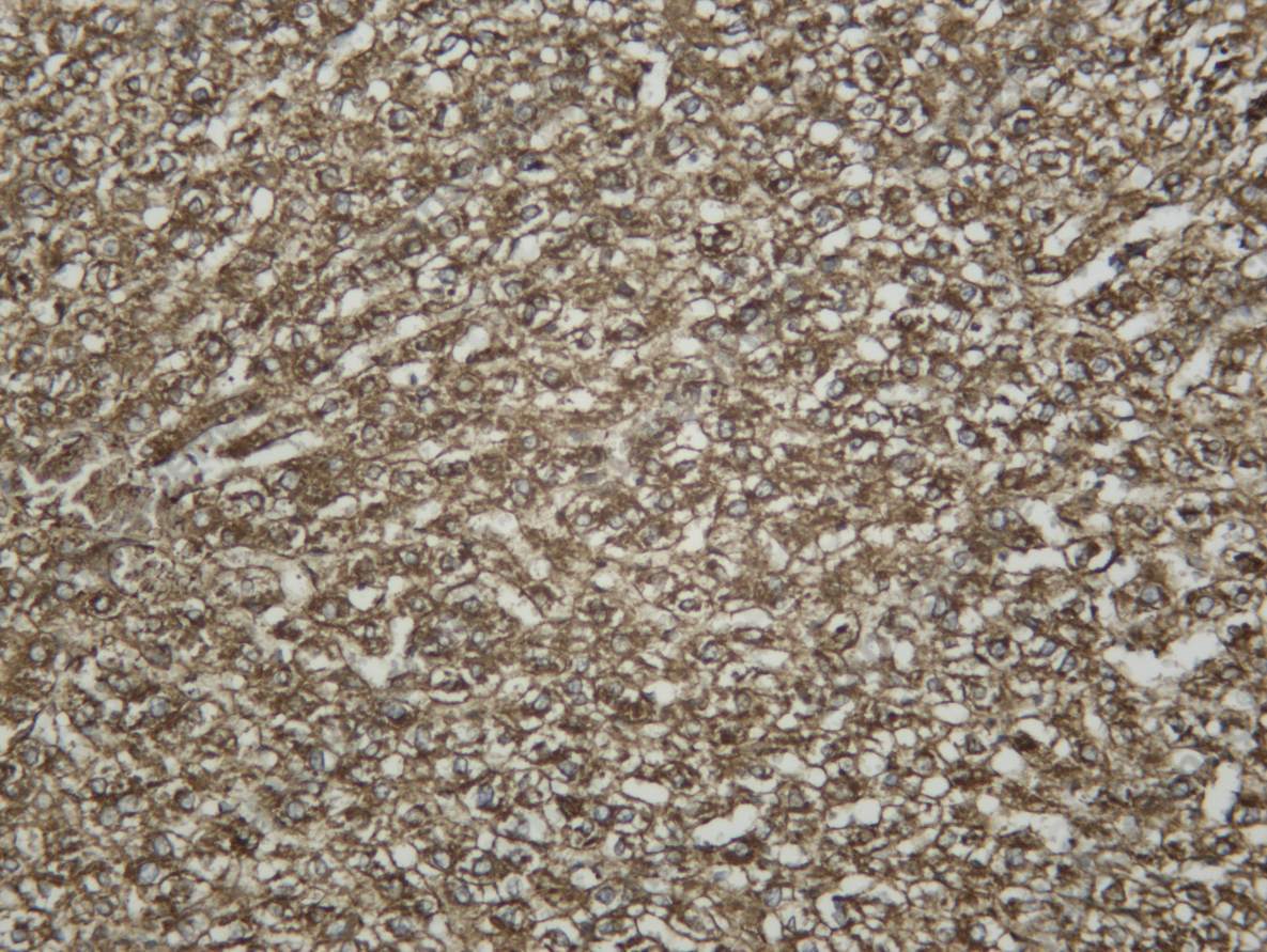 Recombinant C3 Monoclonal Antibody - 6