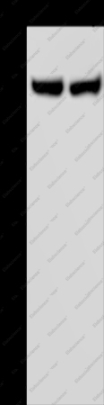 ITGA2B Polyclonal Antibody - 1