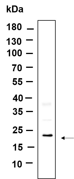 Recombinant TXD12 Monoclonal Antibody-searchlist-1