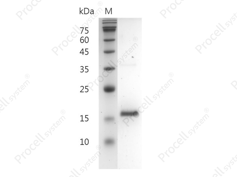 FGF-2/bFGF/FGF-b, Human, Recombinant