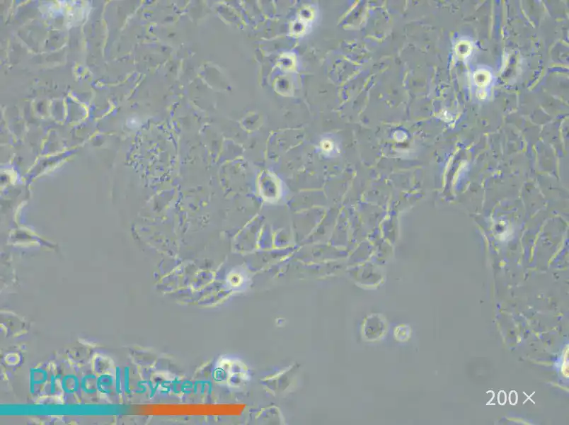 AMC-HN-8 Cell Complete Medium - 6