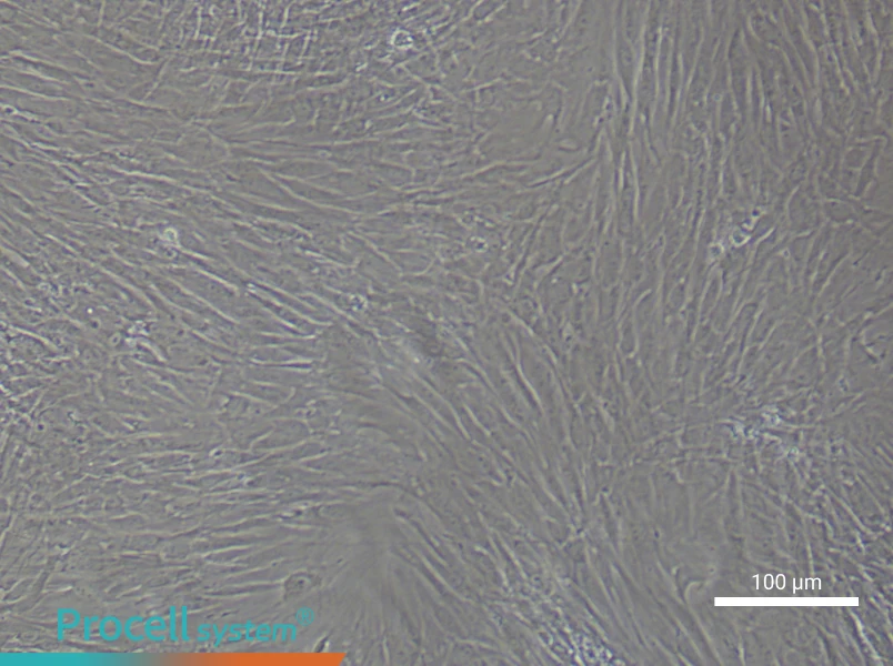 Human Keloid Fibroblast Complete Medium - 3