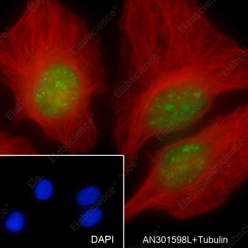 Recombinant MCM5 Monoclonal Antibody - 4
