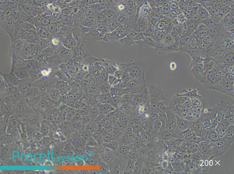 JEG-3 Cell Complete Medium - small - 5