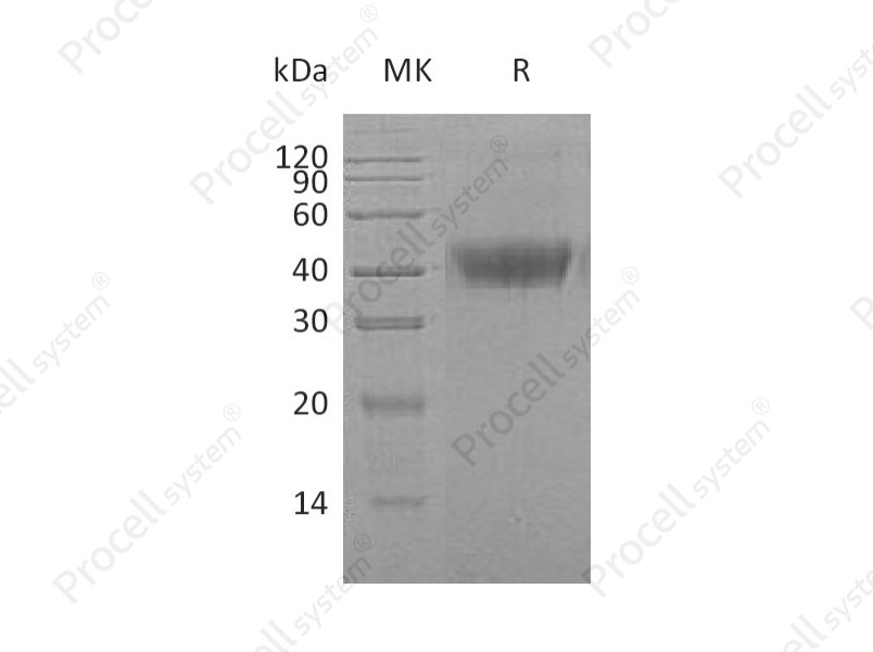 M-CSF/CSF-1/MGI-IM, Human, Recombinant
