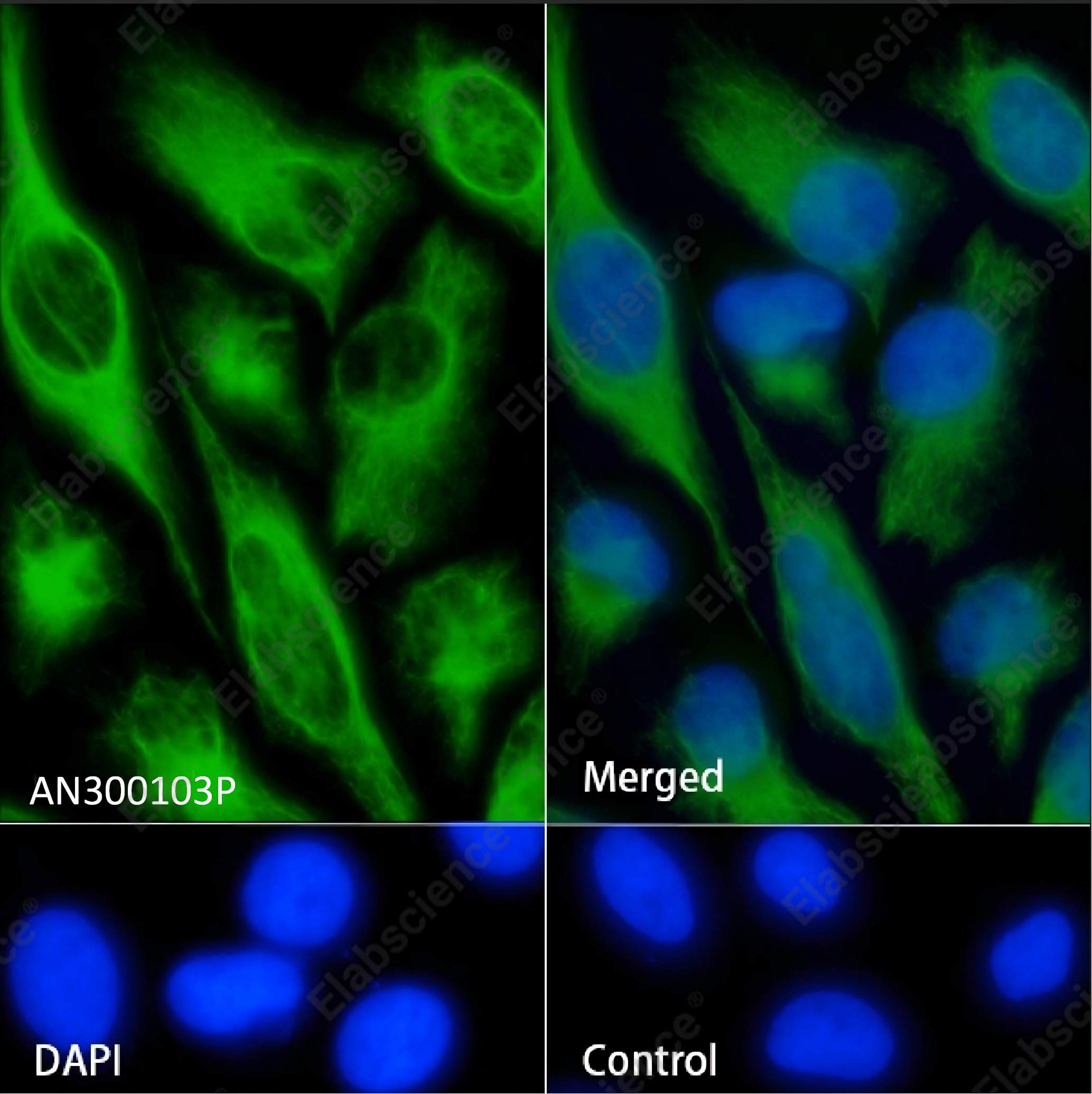 Recombinant Vimentin/VIM Monoclonal Antibody - 5