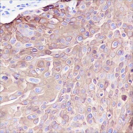 Recombinant Keratin 13 Monoclonal Antibody - 2
