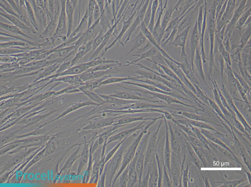 Human Skeletal Muscle Fibroblast Complete Medium - 4