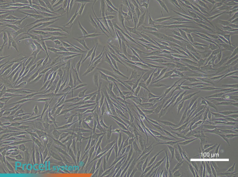 Human Mammary Cancer Fibroblast Complete Medium - 1