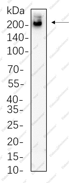 Recombinant Tuberin Monoclonal Antibody - 1