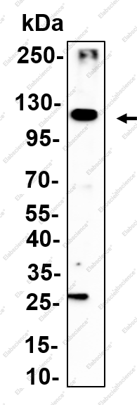 Recombinant EphB3 Monoclonal Antibody - 3
