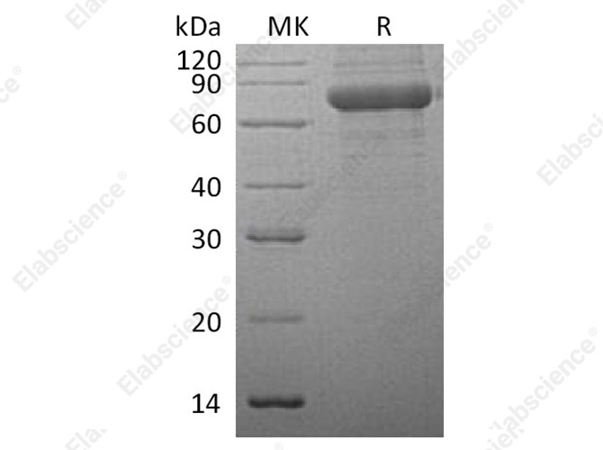 Recombinant Human TPP1/CLN2 Protein (His Tag) - 1