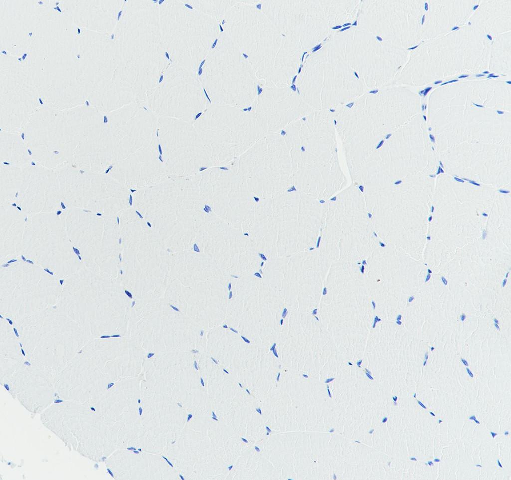 Recombinant ADA2 Monoclonal Antibody - small - 4