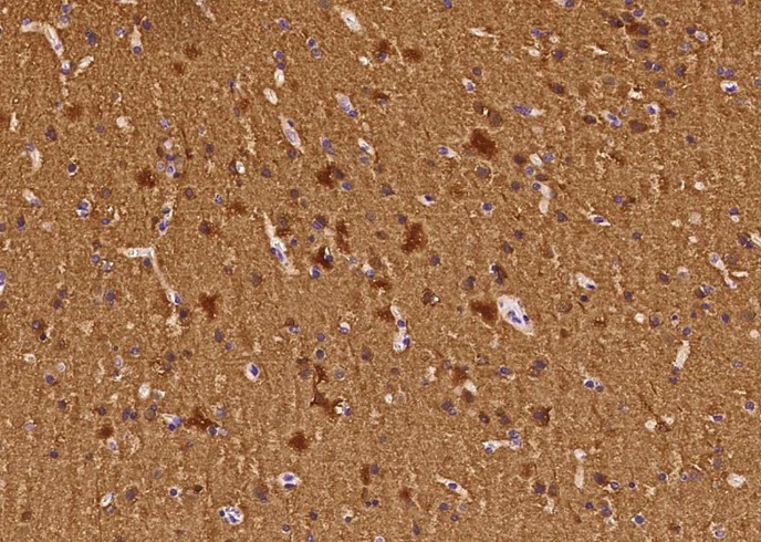 ENO2 Monoclonal Antibody - small - 2