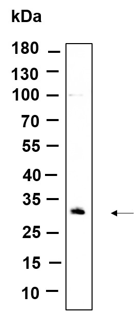 Recombinant CDIN1 Monoclonal Antibody-searchlist-1