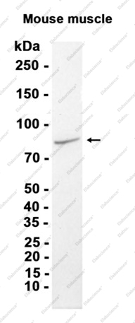 Recombinant PI3 Kinase p85 alpha Monoclonal Antibody - 2