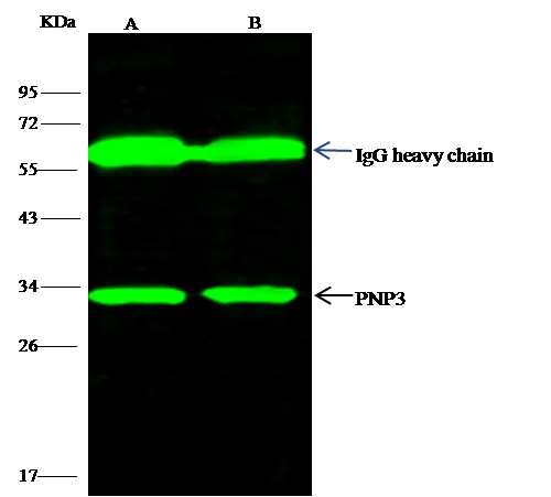 Recombinant Purine nucleoside phosphorylase/PNP Monoclonal Antibody - small - 2