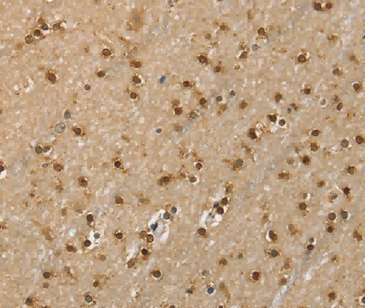 RNH1 Polyclonal Antibody - 3