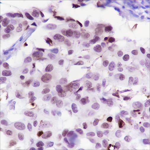 Recombinant Cleaved PARP1 p25 Monoclonal Antibody - 2