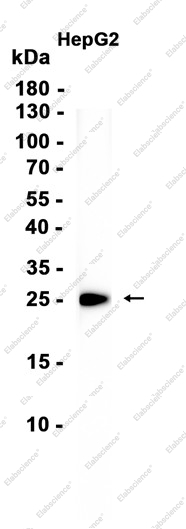 Recombinant Casein Kinase 2 beta Monoclonal Antibody - 3