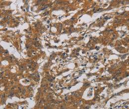 CNDP1 Polyclonal Antibody - 2