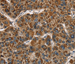 CAT Polyclonal Antibody - 3