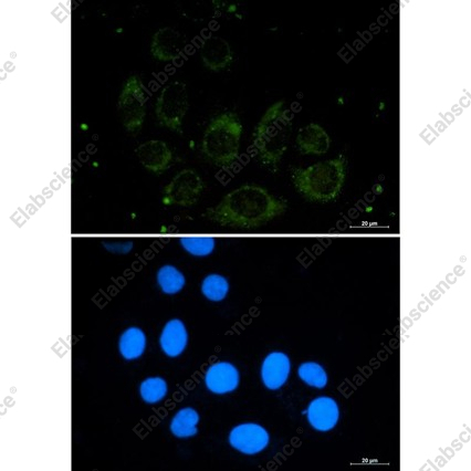 Recombinant Protein CASP Monoclonal Antibody - 3