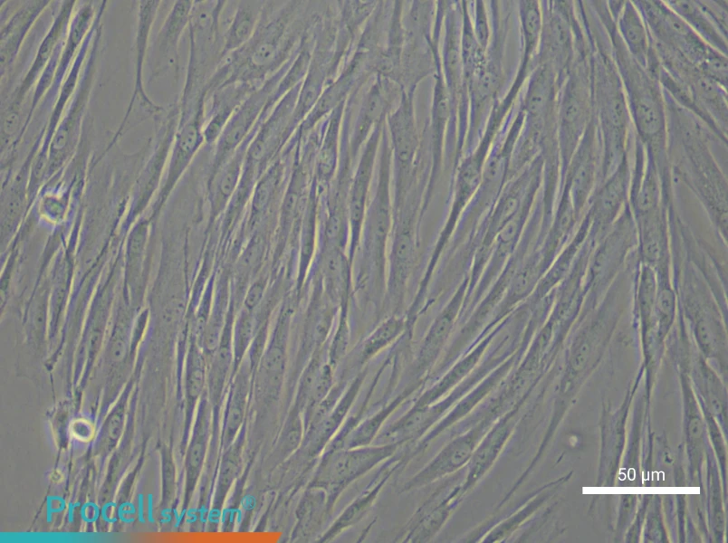 Human Endometrial Stromal Cell Complete Medium - 5