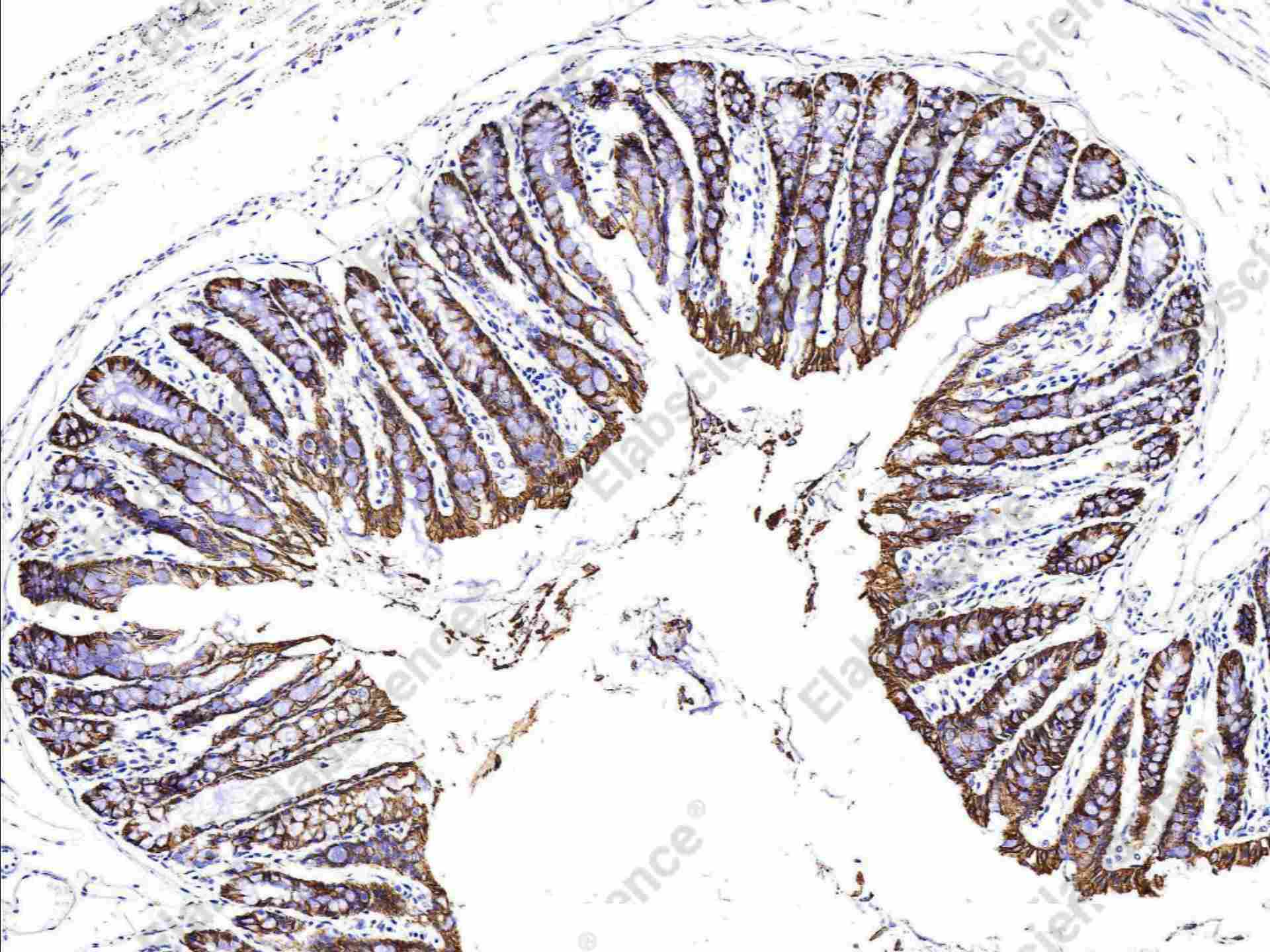 Recombinant EpCAM/TROP-1/TACSTD1 Monoclonal Antibody - 2