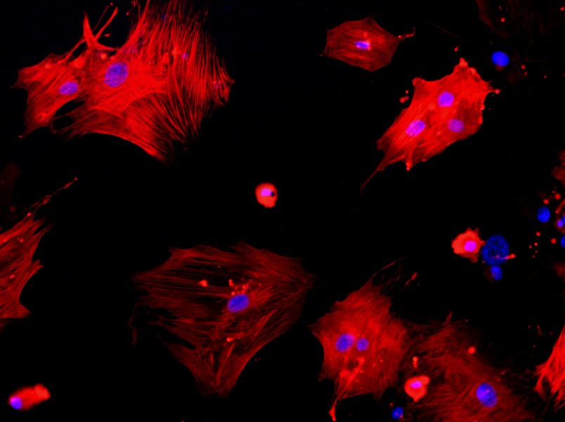 Mouse Aortic Smooth Muscle Cell Complete Medium - 2