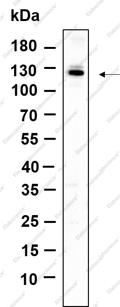 Recombinant Dnmt3a Monoclonal Antibody - 1